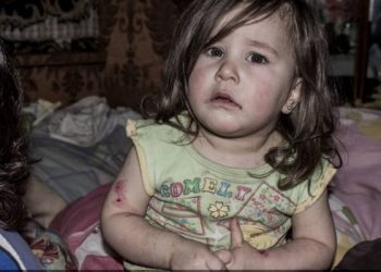 Stunt, Undernourished and Not Attending School: Children in Armenia “Are Protected”