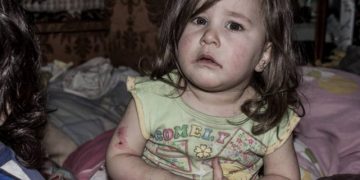 Недоразвитые, недоедающие и не посещающие школу: дети в Армении «защищены»