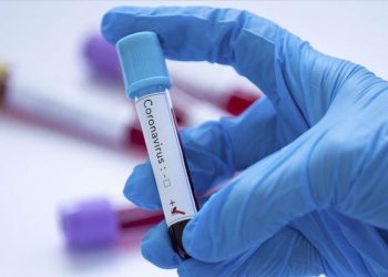 Insurance companies pay for coronavirus testing in Germany: Aram Sargsyan is wrong