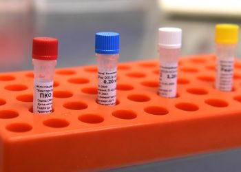 Մեկ միլիոն բնակչի հաշվով Հայաստանում վարակված է 2401 մարդ