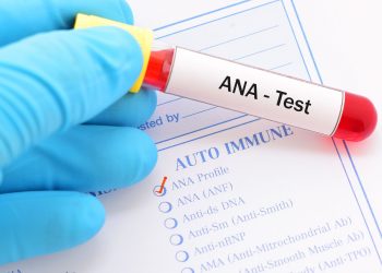 Հակամարմինների դրական թեստը երաշխիք չէ. ուսուցիչները չեն ազատվում պարտավորություններից